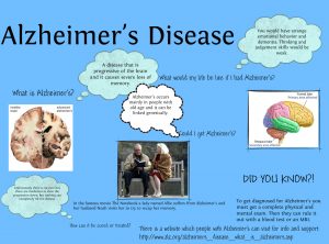 alzheimer-s-disease-source